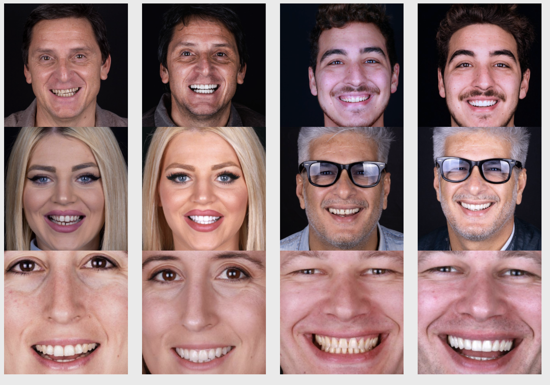 Casos dentales antes y después